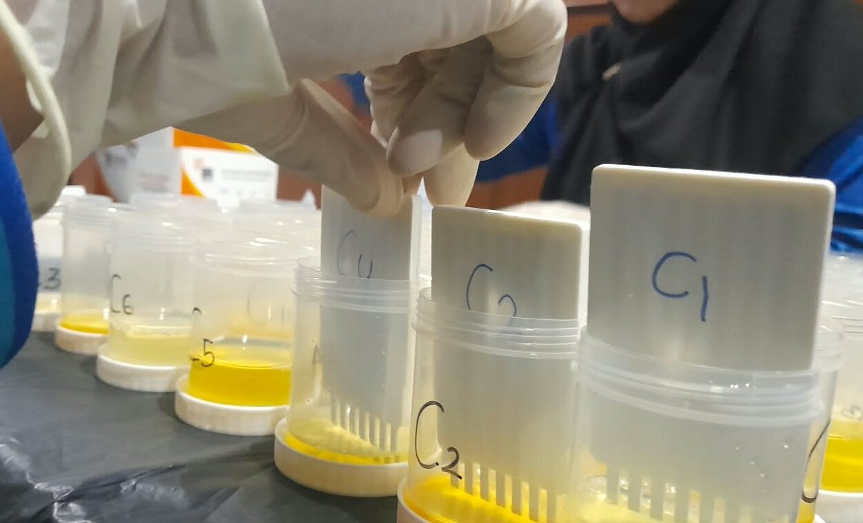 Image of Tes urine (3)